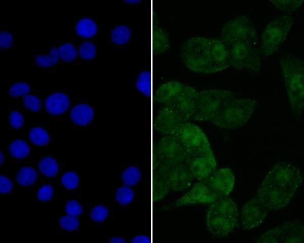ICC staining eIF4A3 in LOVO cells (green)