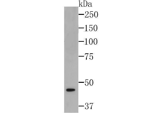 Western blot analysis of eIF4A3 on SiHa cell lysates using anti-eIF4A3 at 1/500 dilution