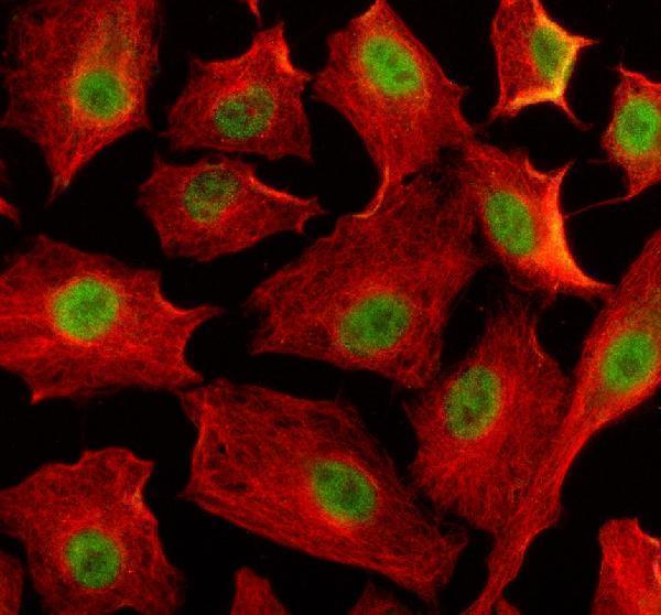 a03095 2 eif4a3 primary antibodies if testing 1