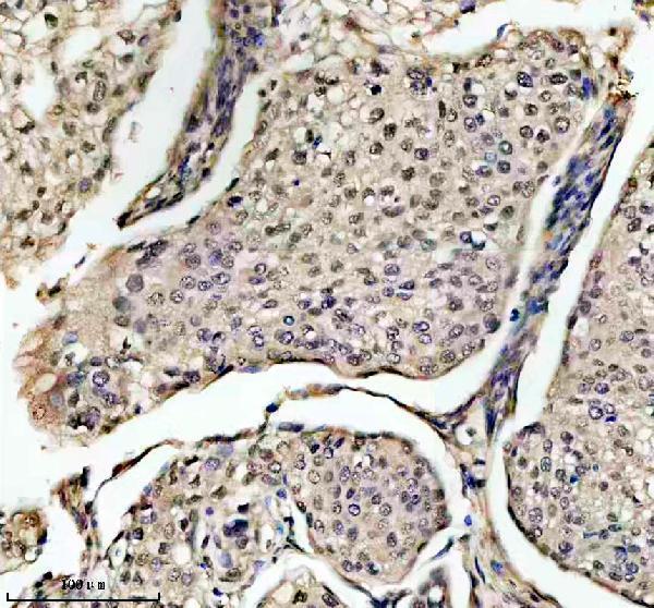 IHC analysis of EIF4A3 using anti-EIF4A3 antibody (A03095-2)