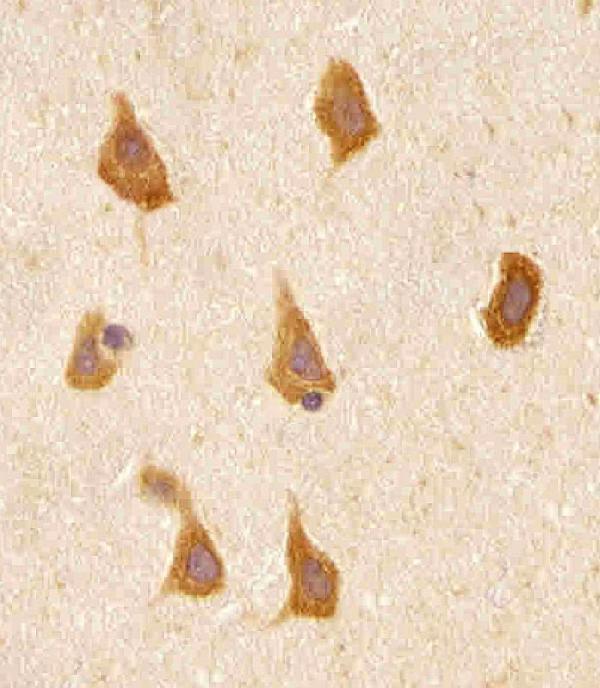 a03098 1 anti prex1 antibody c term ihc p testing 3