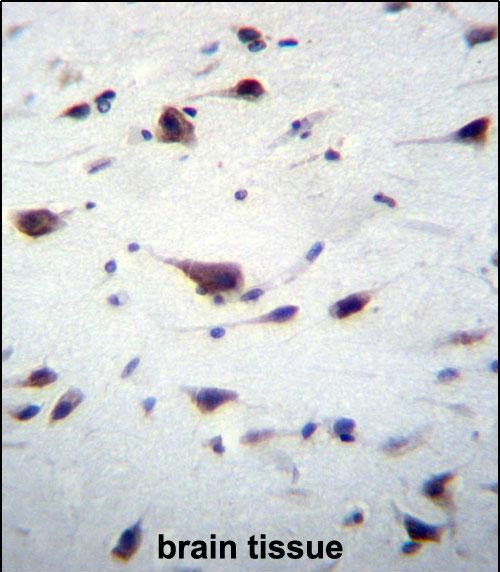 a03098 1 anti prex1 antibody c term ihc p testing 4