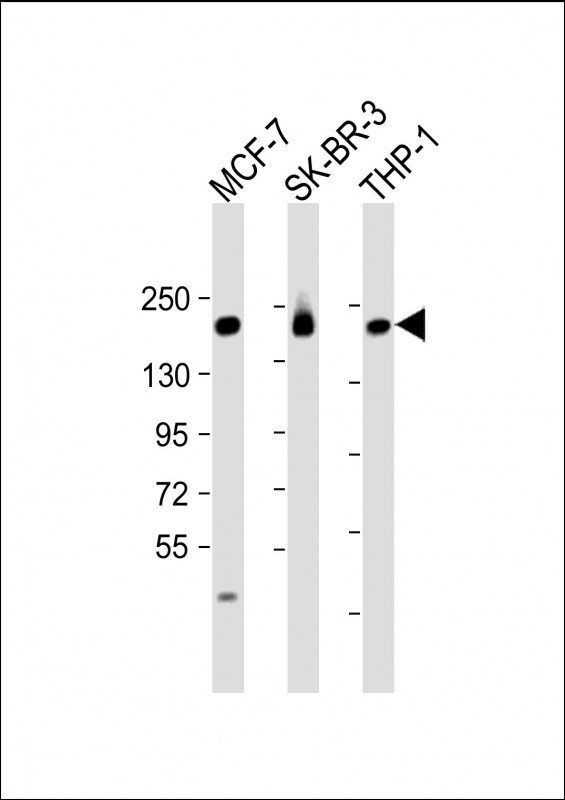 a03098 1 anti prex1 antibody c term wb testing 1