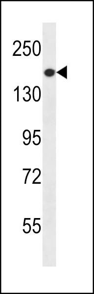 a03098 1 anti prex1 antibody c term wb testing 2