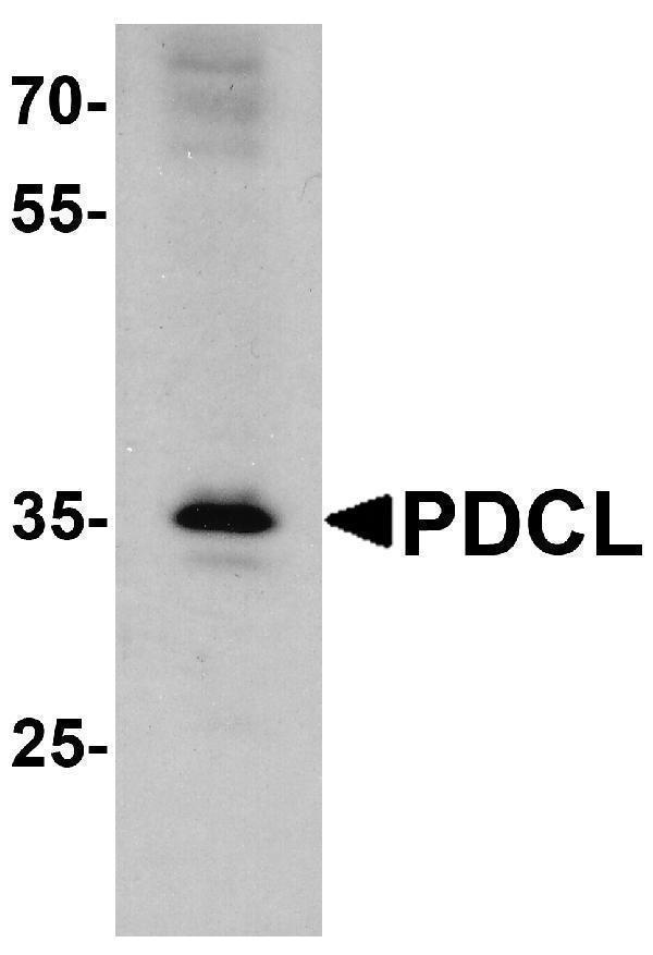 Western blot analysis of PDCL in K562 cell lysate with PDCL antibody at 1 μg/ml