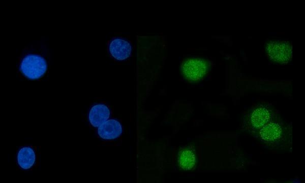  IF analysis of Hsp40/DNAJB1 using anti-Hsp40/DNAJB1 antibody (A03100-1)