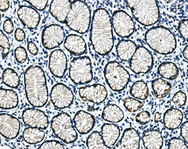  IHC analysis of Hsp40/DNAJB1 using anti-Hsp40/DNAJB1 antibody (A03100-1)