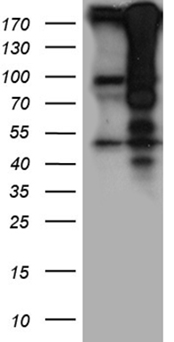 a03101 1 anti hira rabbit polyclonal antibody wb testing 1