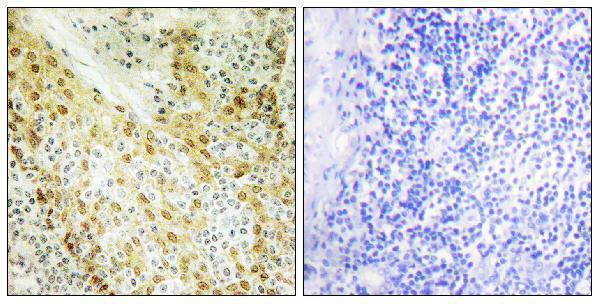 a03101 hira primary antibodies ihc testing 1