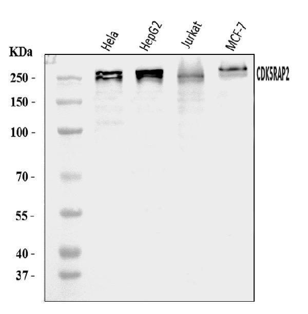  Western blot analysis of CDK5RAP2 using anti-CDK5RAP2 antibody (A03102-2)