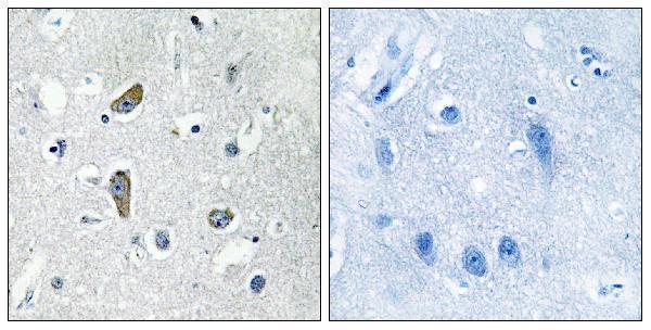 a03102 cdk5rap2 primary antibodies ihc testing 1