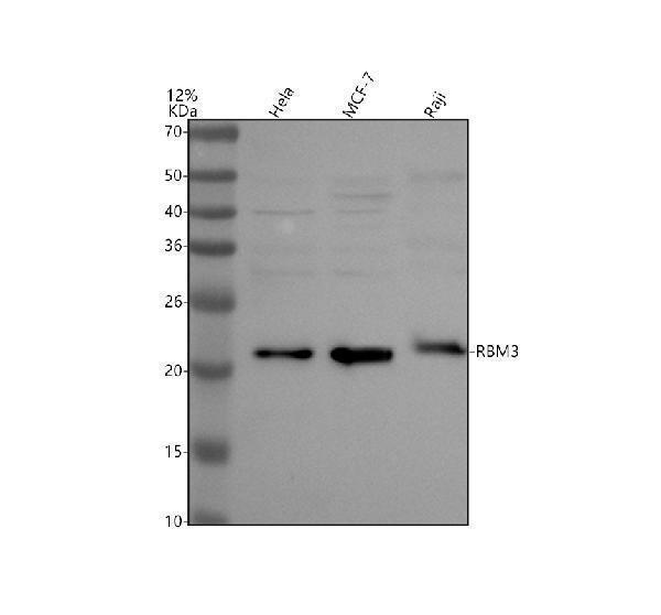 Western blot analysis of RBM3 using anti-RBM3 antibody (A03104-2)