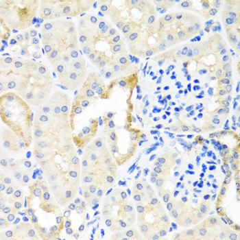 a03105 1 tdgf1 primary antiboties ihc testing 2