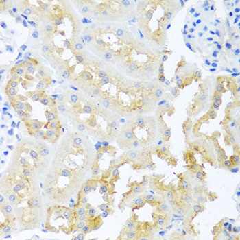 a03105 1 tdgf1 primary antiboties ihc testing 3