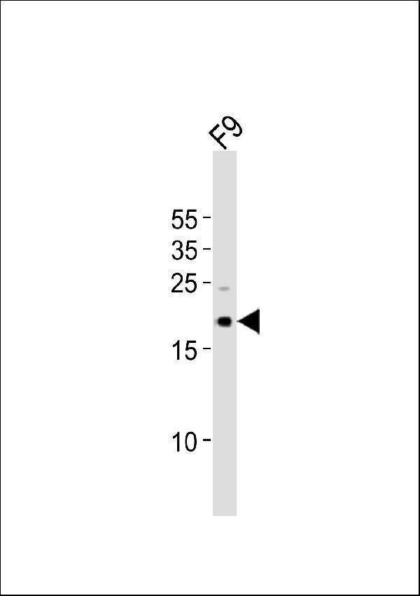 a03105 anti mouse tdgf1 antibody n term wb testing 1
