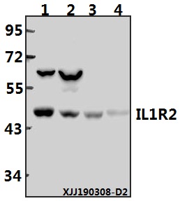 Western blot (WB) analysis of IL1R2 polyclonal antibody at 1:500 dilution
Lane1:Jurkat whole cell lysate(20µg)
Lane2:HEK293T whole cell lysate(40µg)
Lane3:The Kidney tissue lysate of Rat(40ug)
Lane4:The Heart tissue lysate of Mouse(40ug)