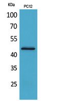 Western Blot analysis of PC12 cells using IL-1RII Polyclonal Antibody