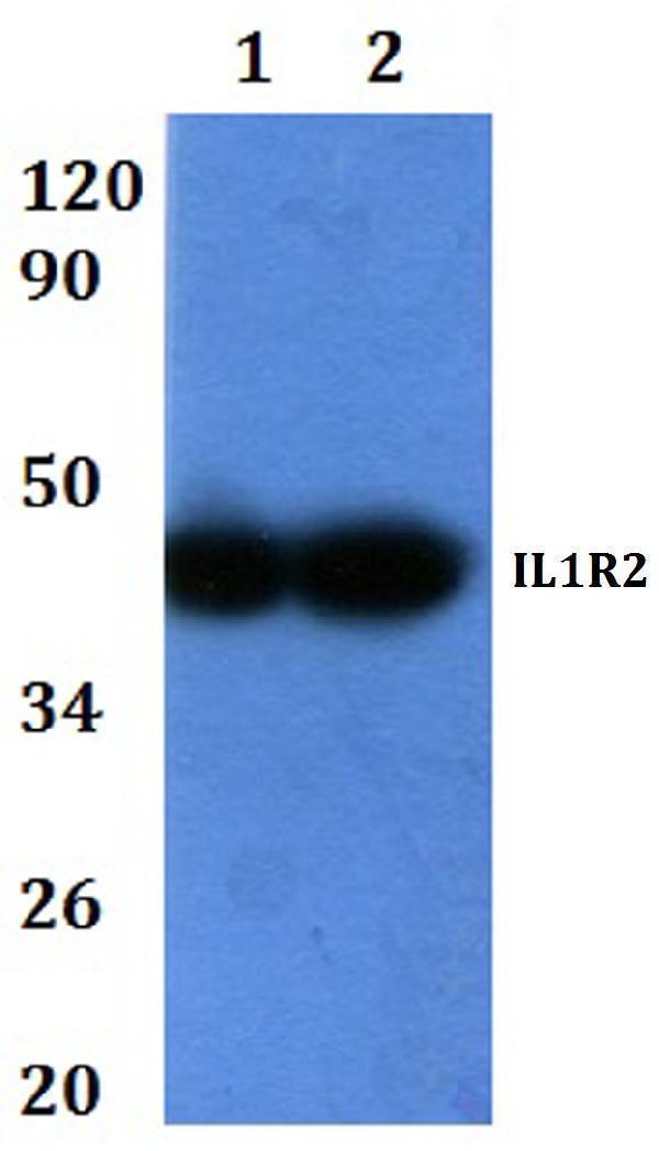 Western blot (WB) analysis of IL1R2 polyclonal antibody at 1:500 dilution  Lane1:HEK293T whole cell lysate
Lane2:RAW264