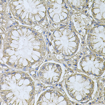a03108 1 ptp4a3 primary antiboties ihc testing 2