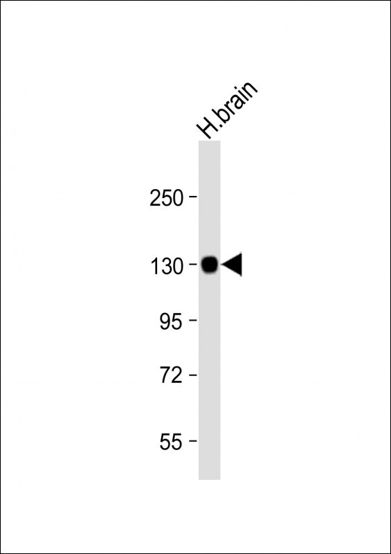 ENPP2 Antibody (Center) (Cat. #A03110-1) flow cytometric analysis of MDA-MB435 cells (right histogram) compared to a negative control cell (left histogram). FITC-conjugated goat-anti-rabbit secondary antibodies were used for the analysis. ENPP2 Antibody (Center) (Cat. #A03110-1) flow cytometric analysis of MDA-MB435 cells (right histogram) compared to a negative control cell (left histogram). FITC-conjugated goat-anti-rabbit secondary antibodies were used for the analysis.
