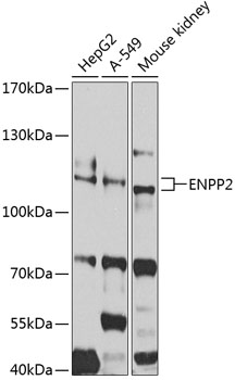 Western blot analysis of extracts of various cell lines, using ENPP2 antibody  at 1:1000 dilution