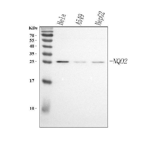  Western blot analysis of NQO2 using anti-NQO2 antibody (A03112-1)