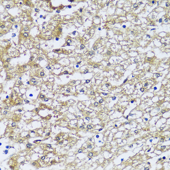 Immunohistochemistry of paraffin-embedded Human liver using NQO2 antibody  at dilution of 1:100 
