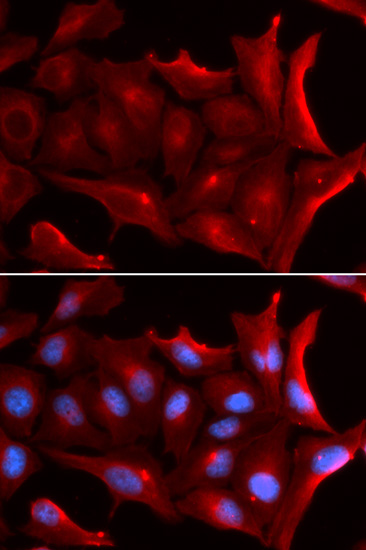 Immunohistochemistry of paraffin-embedded Mouse kidney using NQO2 antibody  at dilution of 1:100 