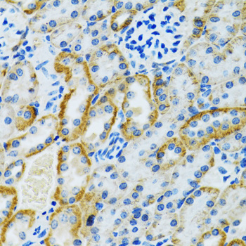 Immunohistochemistry of paraffin-embedded rat kidney using GDAP1 antibody  at dilution of 1:100 
