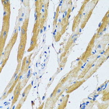 Immunohistochemistry of paraffin-embedded rat heart using GDAP1 antibody  at dilution of 1:100 