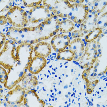 a03114 gdap1 primary antiboties ihc testing 4