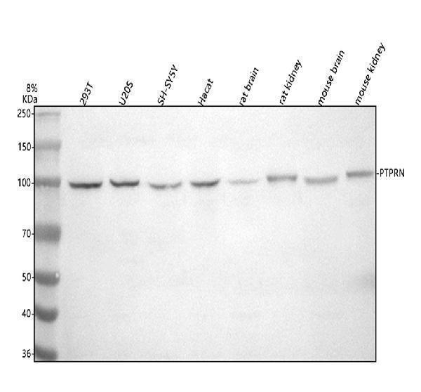  Western blot analysis of IA-2/PTPRN using anti-IA-2/PTPRN antibody (A03116-1)