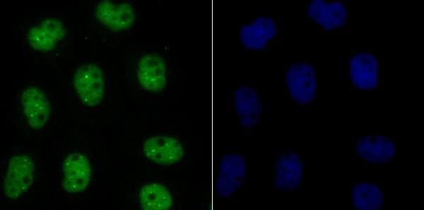 ICC staining Bub3 in A431 cells (green)