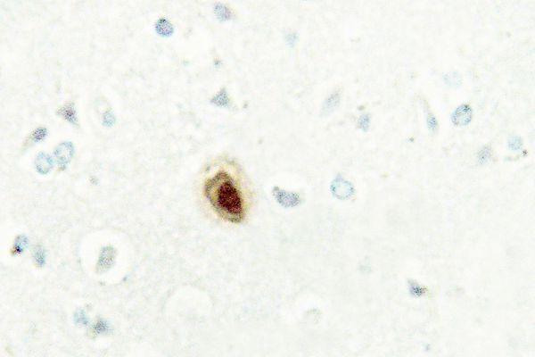 a03118 bub3 primary antiboties ihc testing 2
