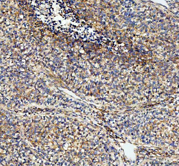 IHC analysis of NOX5 using anti-NOX5 antibody (A03119)