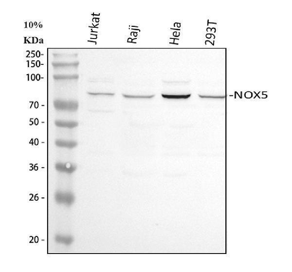  Western blot analysis of NOX5 using anti-NOX5 antibody (A03119)