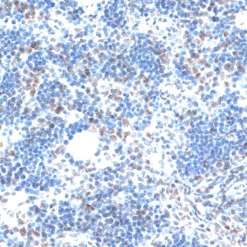 a03121 aqr primary antiboties ihc testing 2