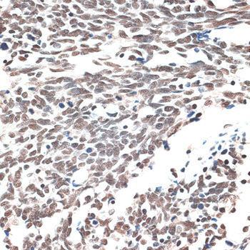 a03121 aqr primary antiboties ihc testing 3