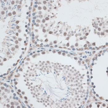 a03121 aqr primary antiboties ihc testing 4