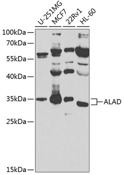 a03122 alad primary antiboties wb testing 1
