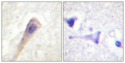 Immunohistochemical analysis of paraffin-embedded Human brain