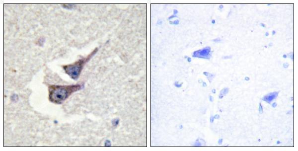 Immunohistochemistry analysis of paraffin-embedded human brain, using Catalase (Phospho-Tyr385) Antibody