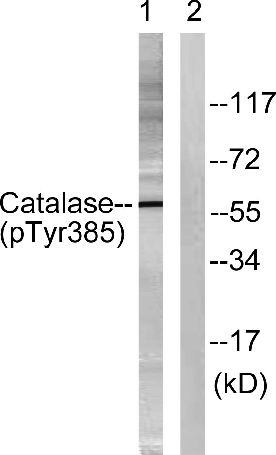 Western blot analysis of lysates from Jurkat cells, using Catalase (Phospho-Tyr385) Antibody