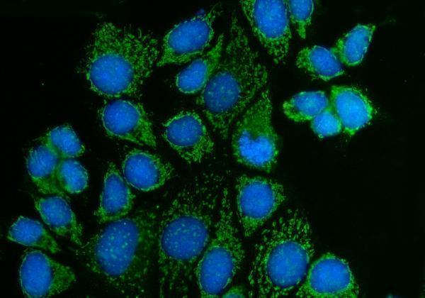 a03124 1 pak3 primary antibodies if testing 5