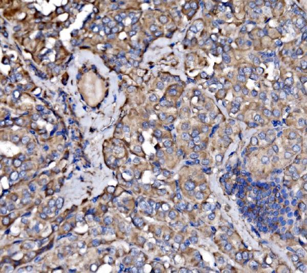 a03124 1 pak3 primary antibodies ihc testing 2