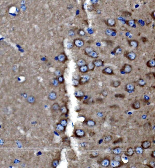 a03124 1 pak3 primary antibodies ihc testing 3