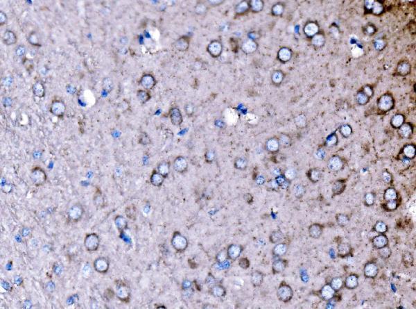 a03124 1 pak3 primary antibodies ihc testing 4