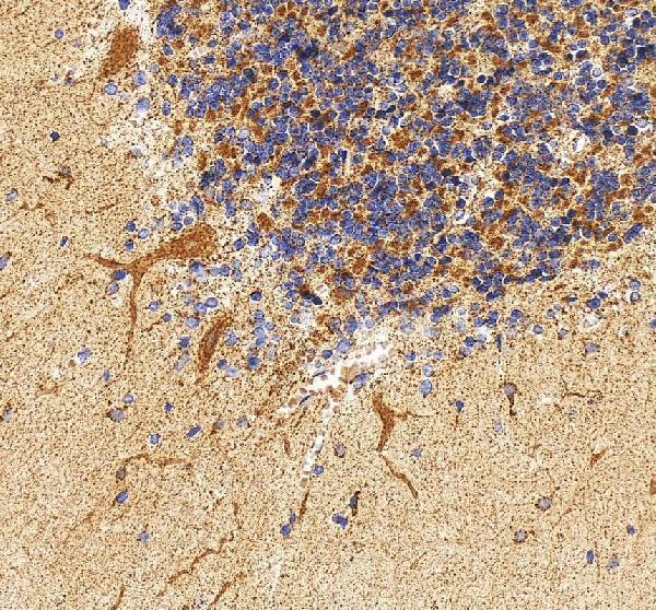 a03124 1 pak3 primary antibodies ihc testing 5