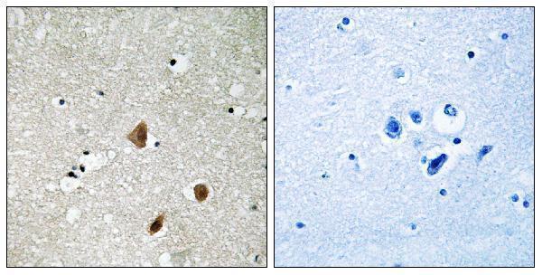 a03124s154 1 pak3 primary antibodies ihc testing 3