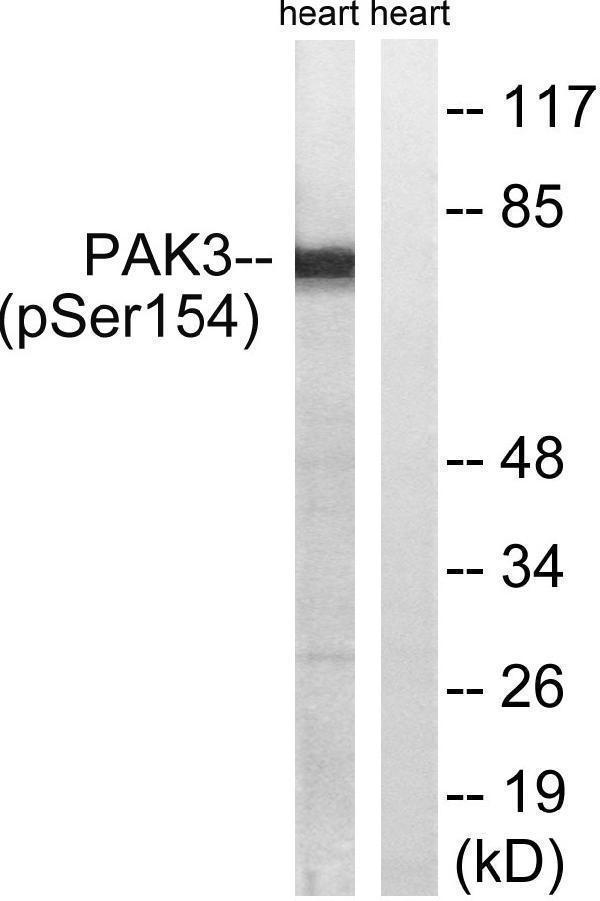 a03124s154 1 pak3 primary antibodies wb testing 2